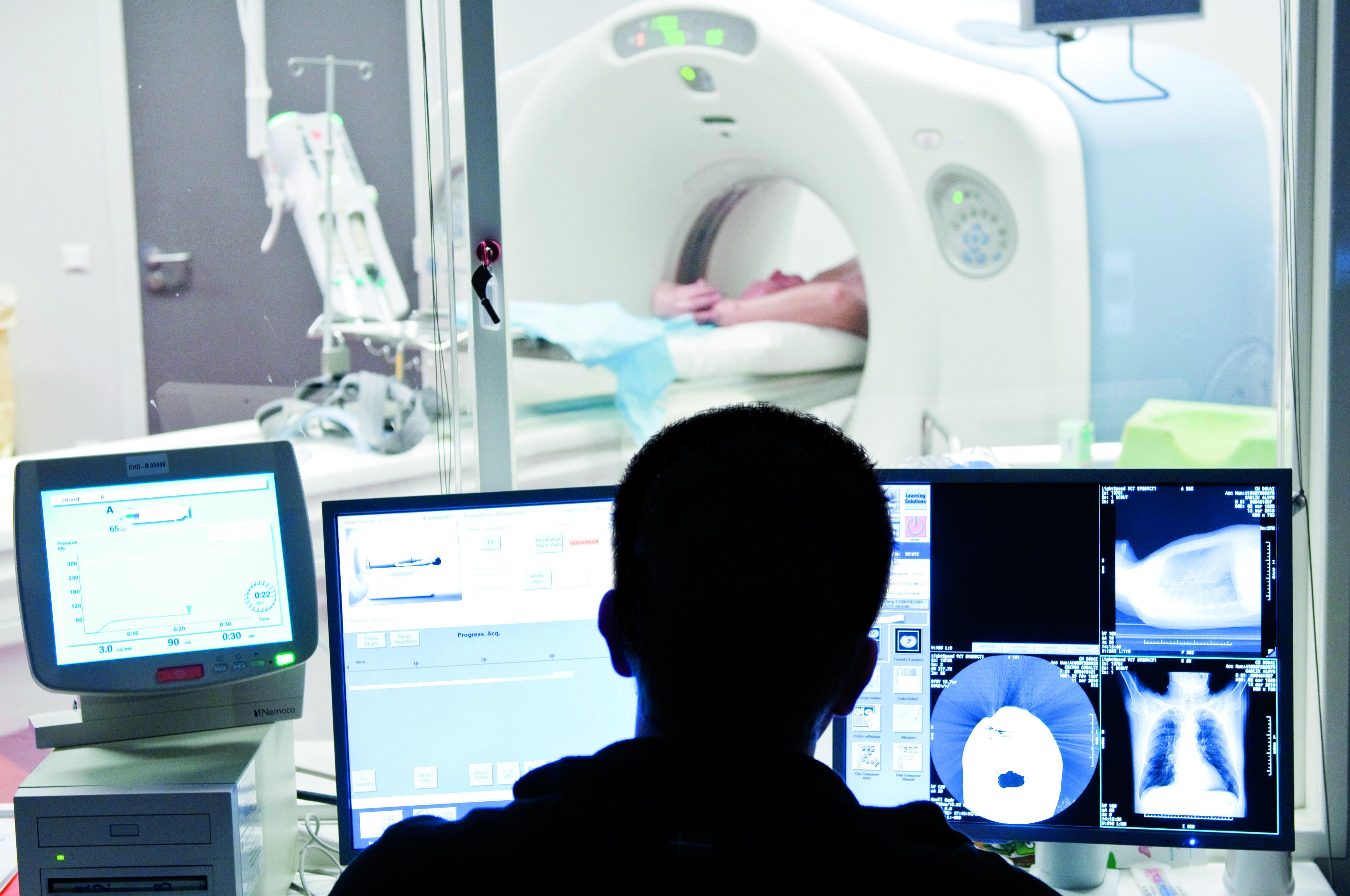 гамма аппарат для лучевой терапии. пэт технолоджи балашиха. дальнефокусная лучевая терапия. цыбульский алексей дмитриевич уролог брахитерапии. последствия стереотаксической лучевой терапии.